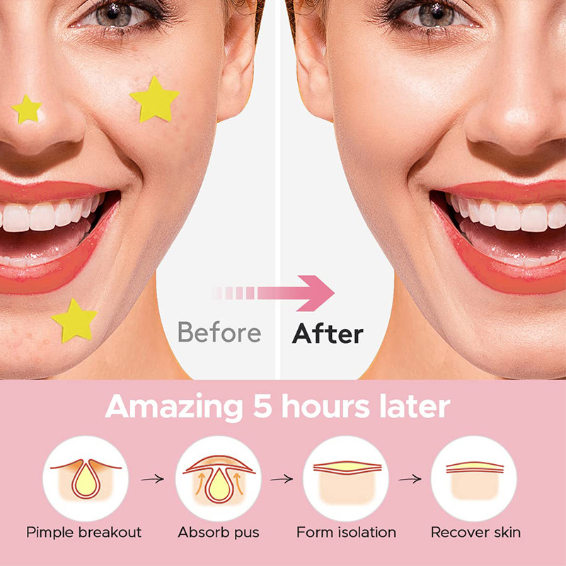 600 sztuk/zestaw Plasterki na  – Beauty Makeup & D Anime Studio recenzja i cena